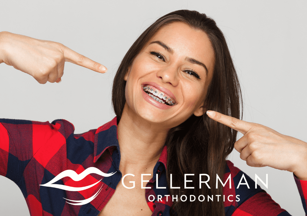 Braces-in-Huntington-NY